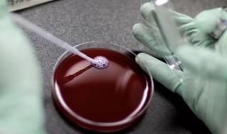 بعد أن كان العلاج الوحيد للمرض هو زرع نخاع العظم.. الغذاء الأمريكية تصرح لأول علاج جيني ل #فقر_الدم_المنجلي