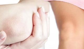 أسرار نعومة الركب والأكواع.. دليل شامل عن كيفية تقشيرها بفعالية والعناية المثلى