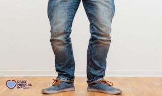 تعرف إلى أسباب ظهور تقوس الساقين عند الأطفال والكبار، وطرق علاج هذه الحالة