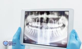 تعد #أشعة_الأسنان خطوة ضرورية لتشخيص مشكلات الفم والأسنان، اكتشف أنواع أشعة الأسنان وأهميتها واستخداماتها