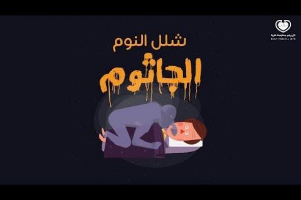#الجاثوم أو #شلل_النوم، هل مررت بهذه التجربة من قبل؟. يصف كل من مر بتجربة الجاثوم بأنهم كانوا غير قادرين على الحركة أو الكلام!! فما سبب هذه الحالة؟. اكتشف من هنا