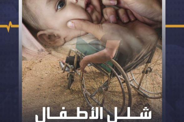مرض تخشاه البشرية كلها.. ماذا تعرفون عن فيروس #شلل_الأطفال وكيفية الوقاية منه؟ #منصة_أكثر #صحة