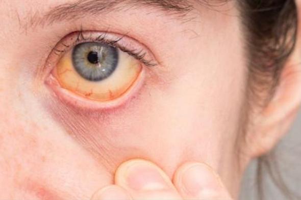 فحوصات مهمة ودورية لصحة العين