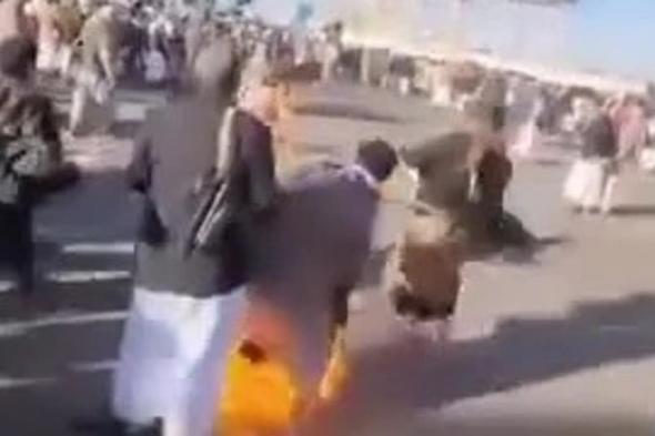 قيادي حوثي يشعل النار بجسده احتجاجاً على "نهب" الجماعة لأرضه